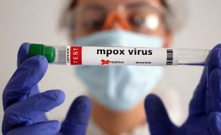 Enquanto isso na Região Norte do Brasil foram registrados vários casos de Mpox!