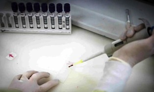 Um paciente em SP com suspeita de Ebola testa positivo para Meningite.