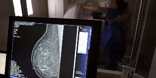 Atenção: Planos de saúde terão que cobrir Mamografia digital para todas as idades.