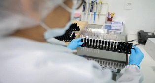 Anvisa autoriza teste em humanos de vacina 100% brasileira contra Malária.
